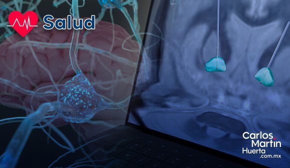 Síndrome de Tourette: La estimulación cerebral profunda podría frenar los tics