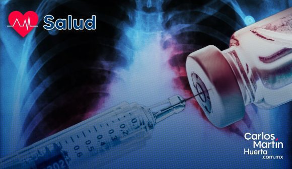 ¡Avance médico! Desarrollan vacuna nasal de ADN para combatir la tuberculosis