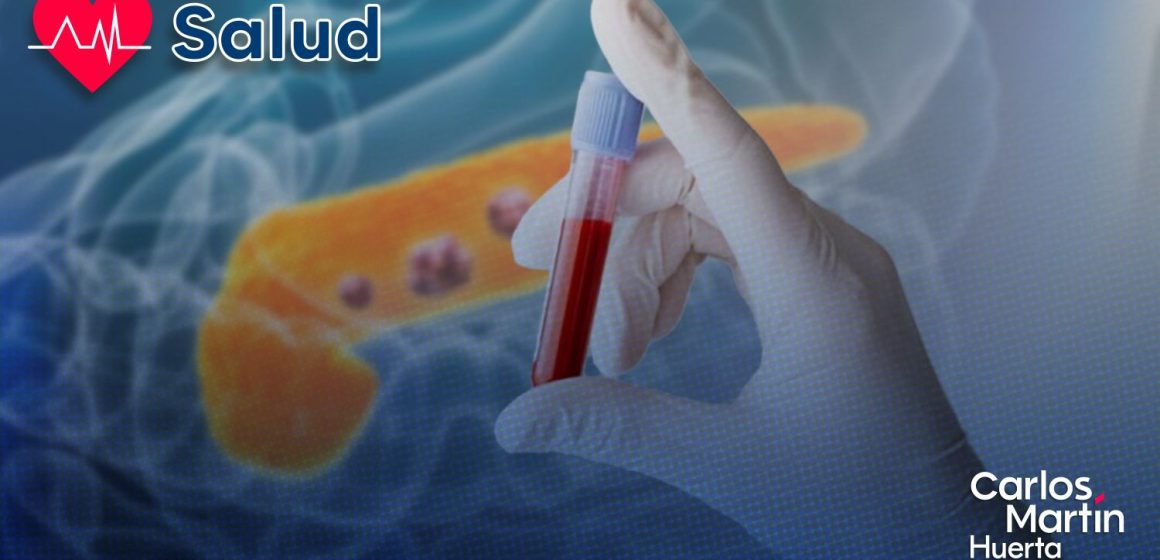 Científicos españoles desarrollan prueba de sangre para detectar cáncer de páncreas en minutos