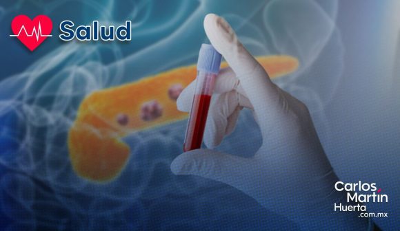 Científicos españoles desarrollan prueba de sangre para detectar cáncer de páncreas en minutos
