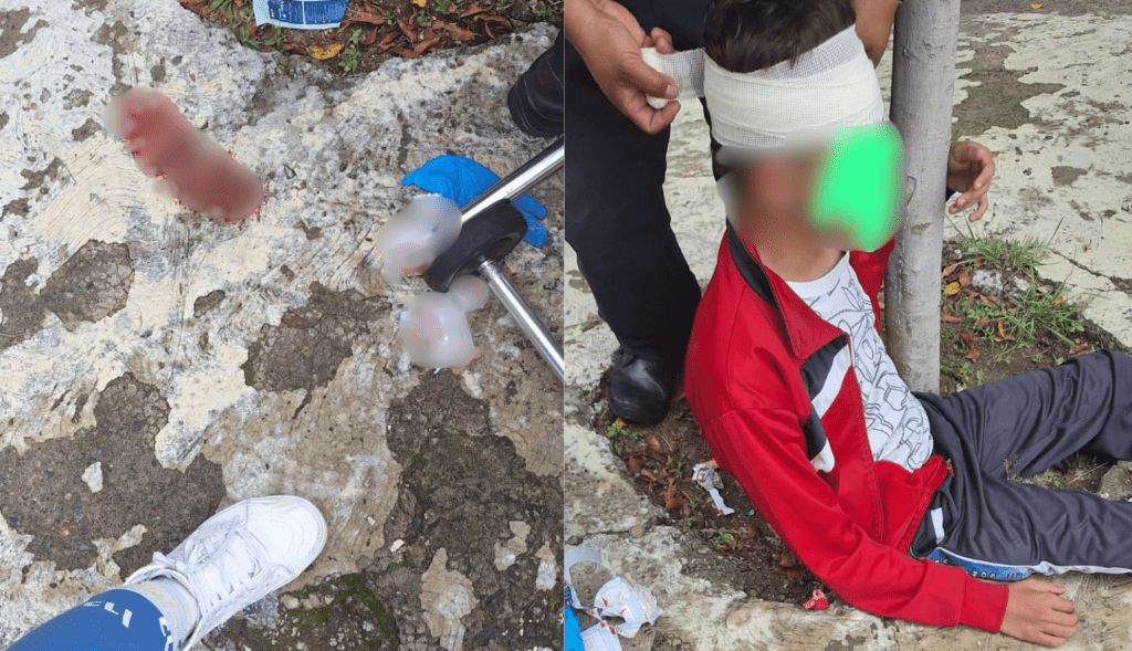 Gobierno de Puebla brinda atención integral a estudiante agredido en Atlixco 2 Diseno sin titulo 4 1