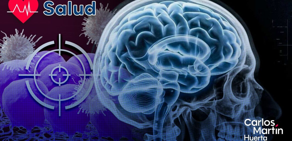 Nueva esperanza contra el glioblastoma- Inmunoterapia ataca el tumor y su escudo protector Nueva esperanza contra el glioblastoma: Inmunoterapia ataca el tumor y su escudo protector