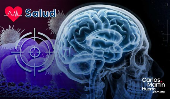 Nueva esperanza contra el glioblastoma: Inmunoterapia ataca el tumor y su escudo protector