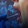 Nueva prueba médica detecta el cáncer oral en una hora sin necesidad de bisturí