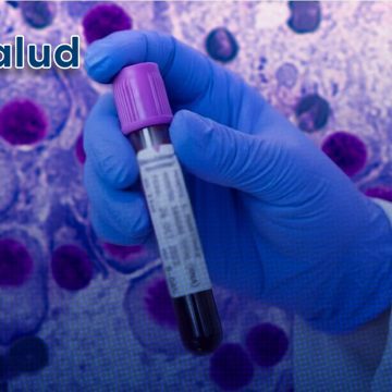Nuevo análisis de sangre predice recaídas de mieloma múltiple con una fiabilidad del 88%