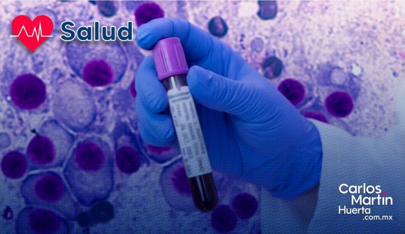 Nuevo análisis de sangre predice recaídas de mieloma múltiple con una fiabilidad del 88%
