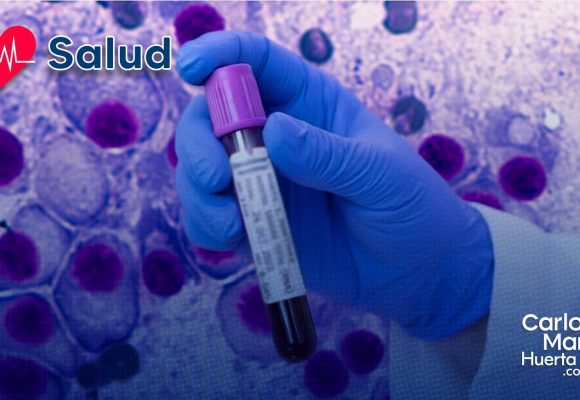 Nuevo análisis de sangre predice recaídas de mieloma múltiple con una fiabilidad del 88%