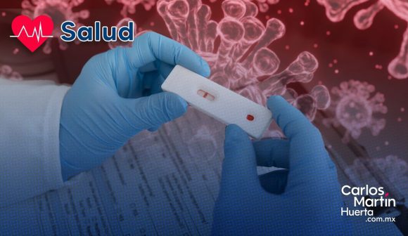 Desarrollan tijeras moleculares capaces de inactivar el VIH en células de laboratorio