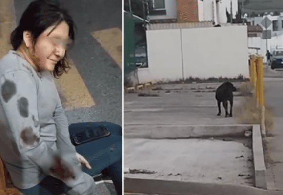 Ataque de perro deja a mujer gravemente herida en Bosques de Chapultepec