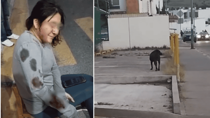 Diseño sin título (76) Ataque de perro deja a mujer gravemente herida en Bosques de Chapultepec