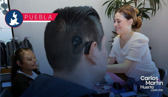SEDIF reactiva actualización de procesadores auditivos en Puebla