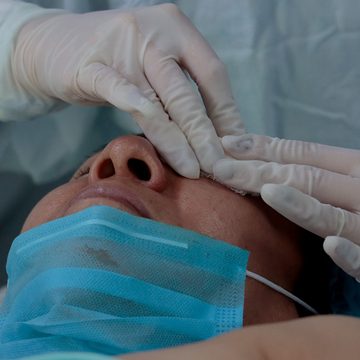 IMSS Puebla opera con éxito a 28 pacientes en jornada de cirugía de cataratas