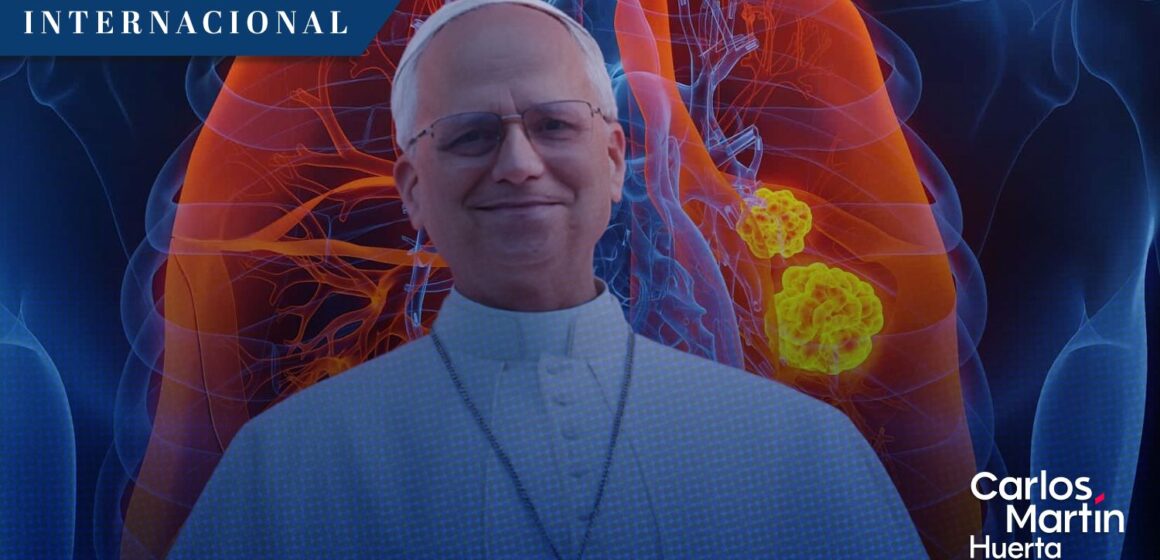 Papa León XIV no requerirá tratamientos adicionales; su cáncer pulmonar estaba localizado