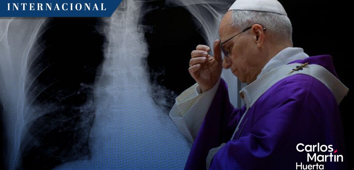 Papa León XIV tenía tumor cancerígeno en el pulmón
