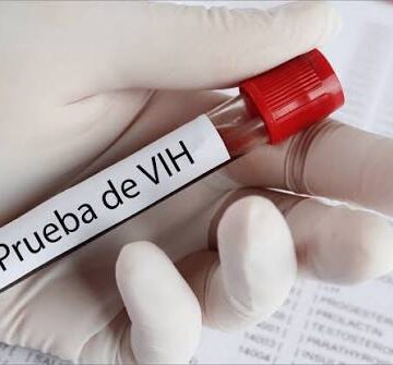 VIH Ofrecerán pruebas gratuitas de VIH, VPH, sífilis y hepatitis C este 14 de octubre en Puebla