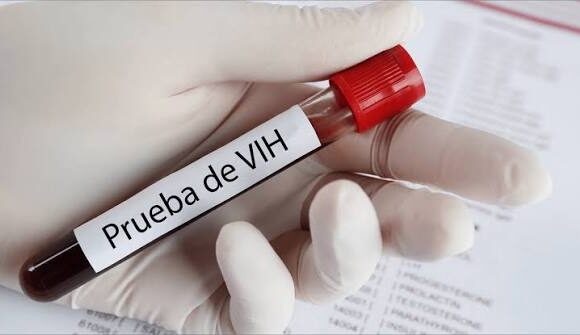 VIH Ofrecerán pruebas gratuitas de VIH, VPH, sífilis y hepatitis C este 14 de octubre en Puebla