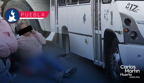 Ruta 17 tira a mujer y le provoca fractura en la pierna